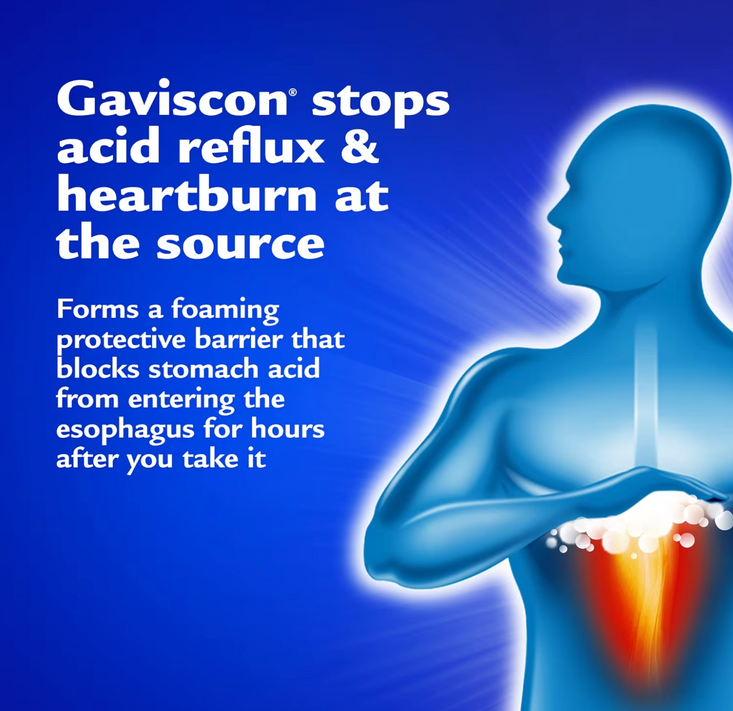 Gaviscon Extra Strength For Acid Reflux, 120 + 25 Chewable Tablets